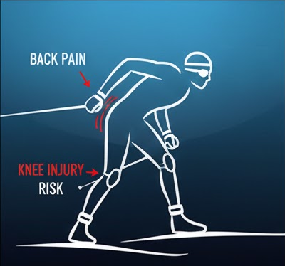 Poor Technique - Risk of injury